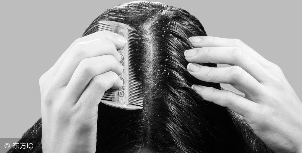 脱发的防脱秘诀,生发防脱发最佳秘方食谱