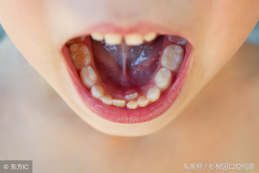 口腔问题你知多少,7个你想了解的口腔问题