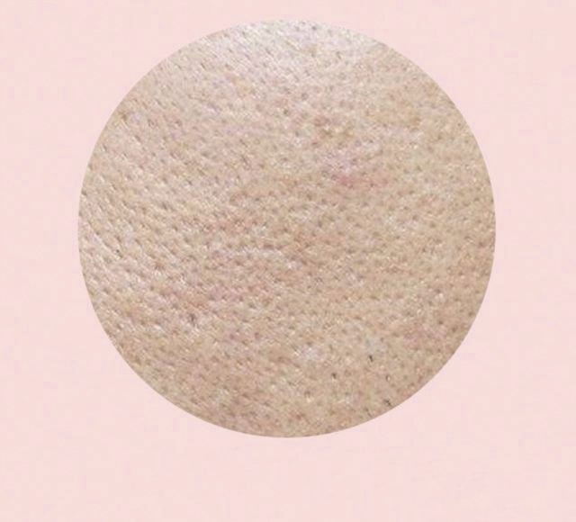 油皮毛孔粗大毛孔多要怎么改善,油皮毛孔粗大护肤品