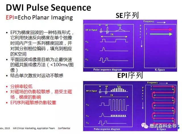 dwi成像序列,dwi序列和edwi序列