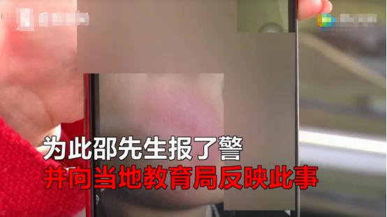 7岁儿童没换牙被打松动了,孩子被晚托班老师打耳光