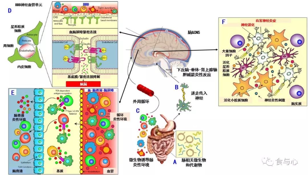 肠漏症的三大指标,肠漏症和脑漏症