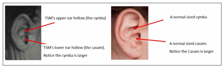 澳大利亚1948年未解悬案,西装男离奇躺在沙滩上,可疑护士被吓晕