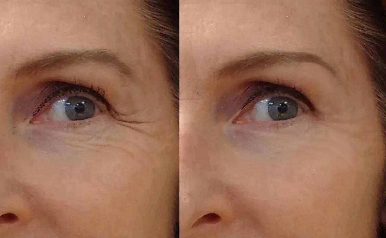 什么？护肤品流行做成“鸳鸯锅”？