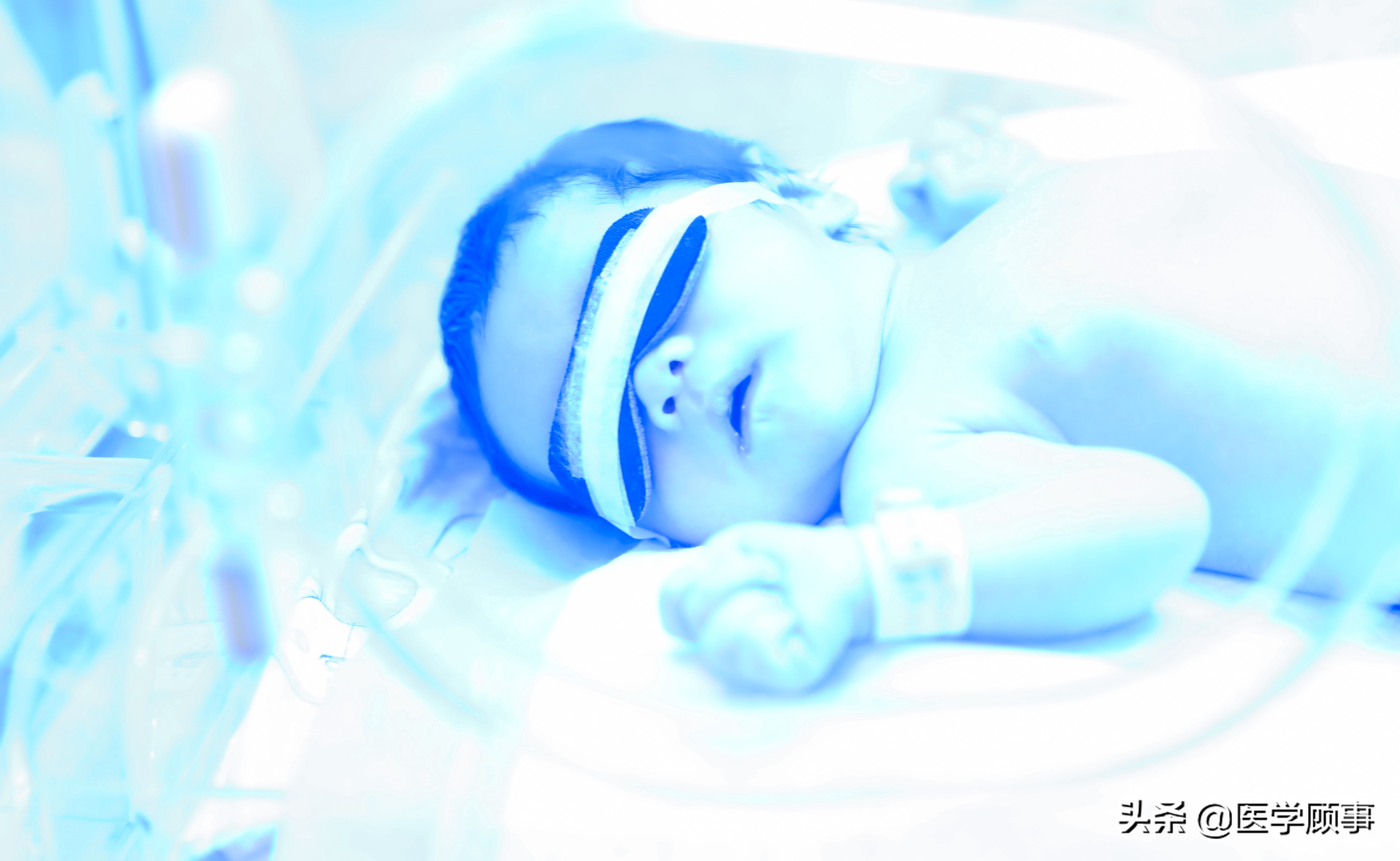 pdca在新生儿窒息复苏中的应用,重症医学科的pdca项目有哪些