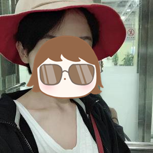 发际线太高怎么办,发际线太高怎么办做什么发型