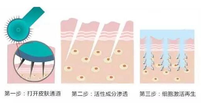 毛孔粗大满脸都是坑,毛孔粗大是糙皮病吗