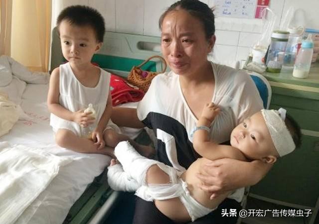 小孩烫伤起水泡要不要挑破,烫伤水泡反复鼓起要反复刺破吗