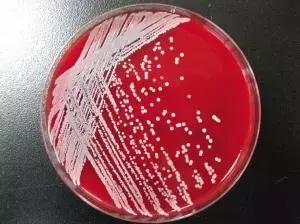 我这手怎么就这么贱呢表情包,手好贱