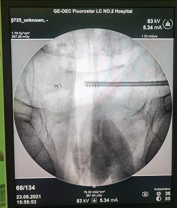摘取皇冠,聊城市人民医院骨外科