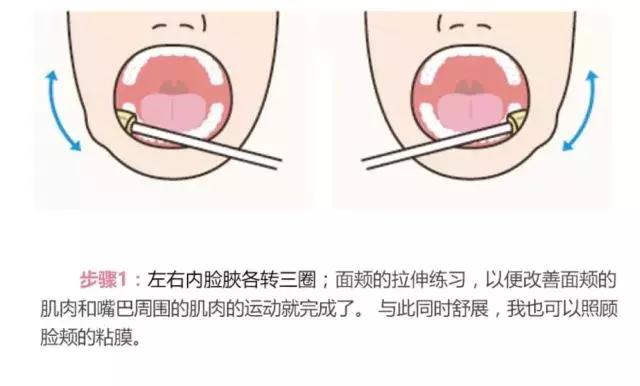 opt口肌评估,opt面部提拉