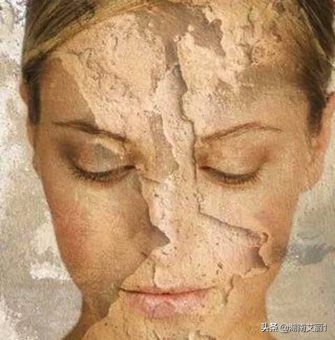 冬天皮肤干燥怎么办最有效的方法,冬天皮肤干燥有什么偏方