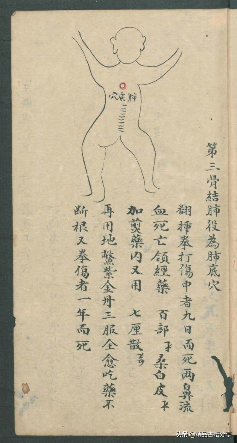 中医类抄本跌打损伤方面的医书欢迎阅读