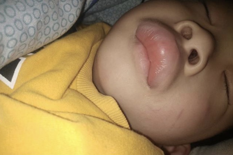 因害怕驱蚊产品有毒放弃驱蚊？帕达诺教你拒绝恶魔在身边