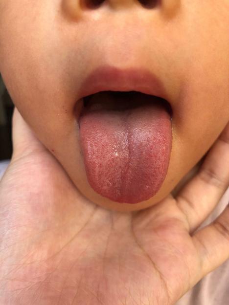 小孩睡觉爱踢被子感觉热,孩子睡觉爱踢被子是内热吗