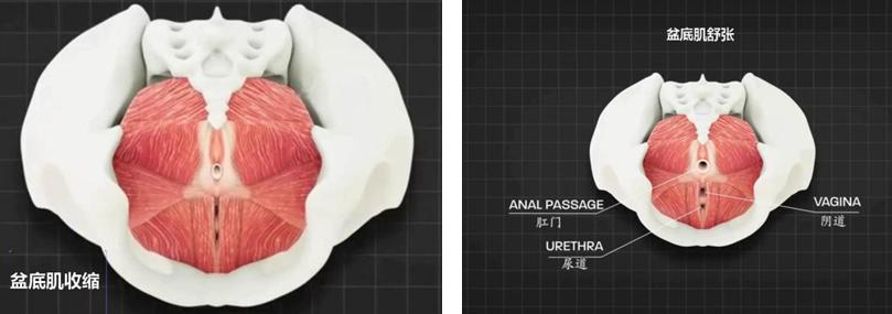 宫颈癌手术后右腿不适是什么原因,宫颈癌术后中危因素要放疗吗