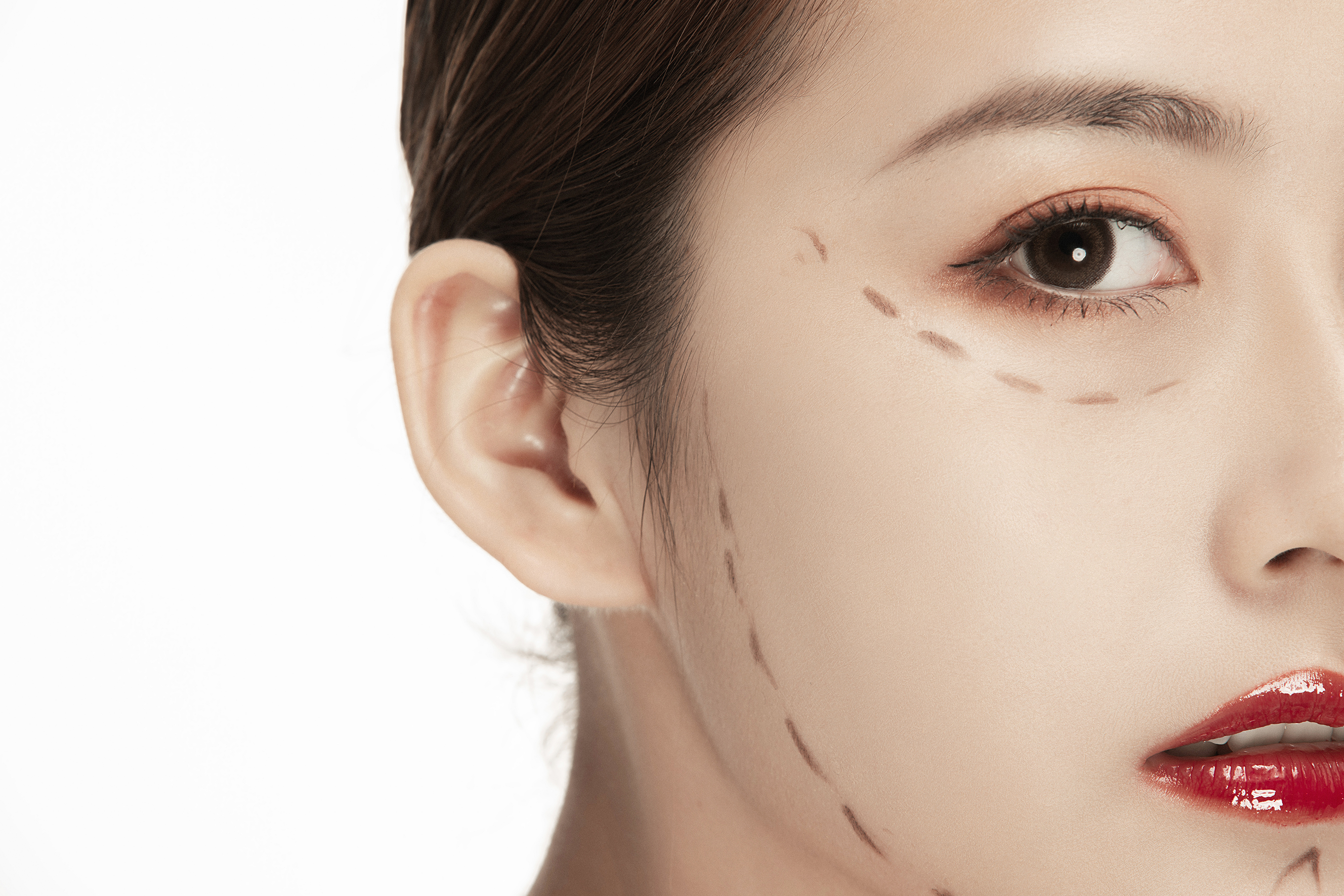 线雕疼痛到什么程度,面部线雕后疼痛