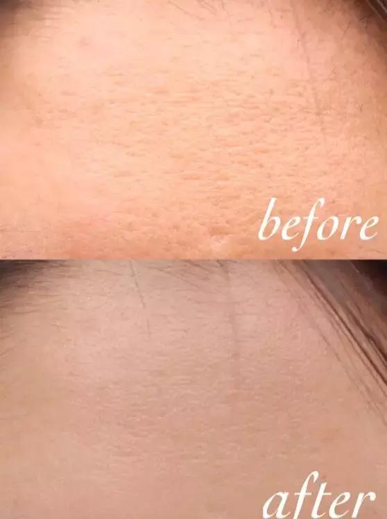 安瓶是什么牌子护肤品,安瓶真的那么好用