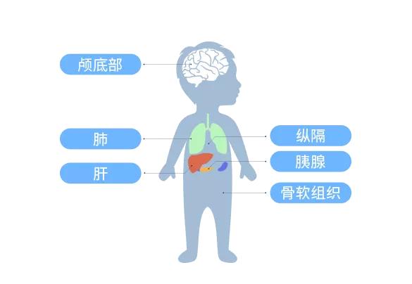 质子治疗癌症的利器,质子治癌细胞靠谱吗