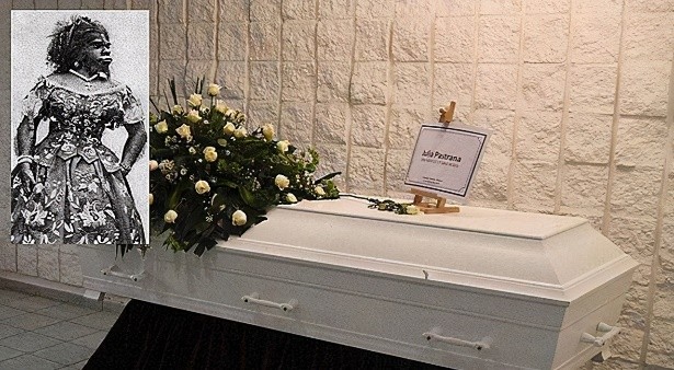 她身高1米38,拒绝20个求婚者,活着被当摇钱树,死后被做成标本