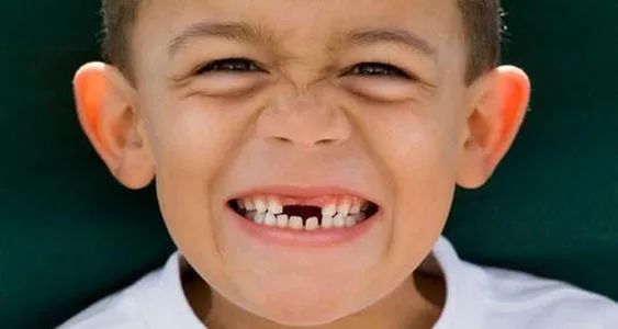 儿童换牙后门牙成大板牙怎么办,儿童换牙门牙长的是尖的怎么回事