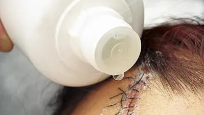 不小心受伤了用什么药好得最快,一不小心磕伤了怎么处理