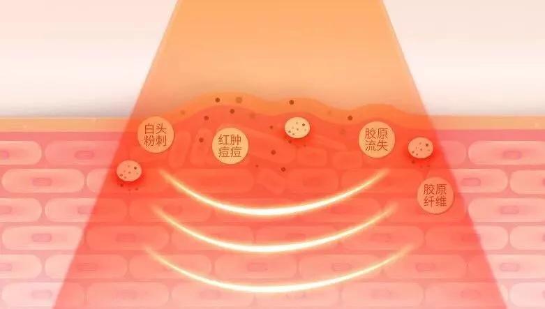 范冰冰卖美容仪也是拼了，拉上吉克隽逸陈乔恩等半个娱乐圈做宣传