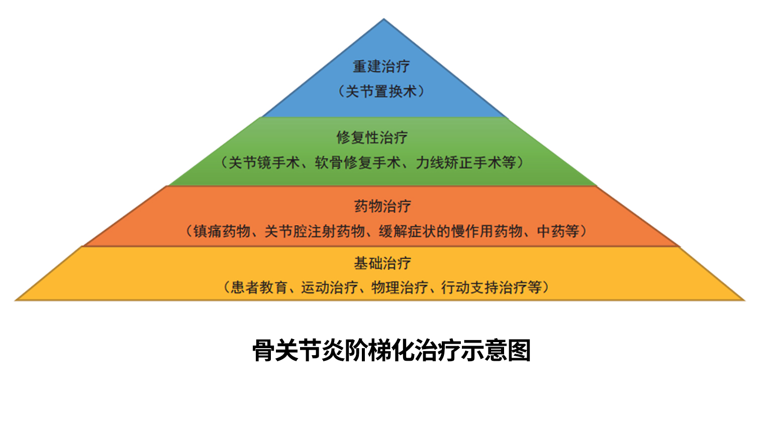 骨关节炎用什么理疗好,骨关节炎用啥药