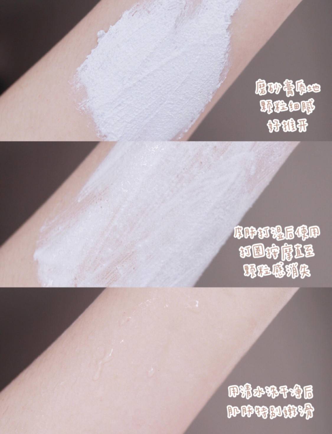 关节去黑小妙招,怎么预防关节变黑