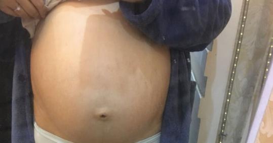 早孕b超什么时候可以查出来,早孕腹部b超和阴超哪个好