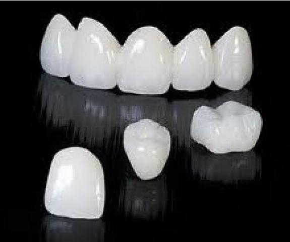 牙齿上出现白斑是怎么回事,牙齿上有白斑是什么原因