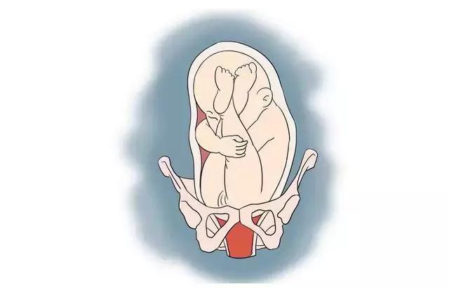 电影中大部分的流产其实都是胎膜早破的现象！