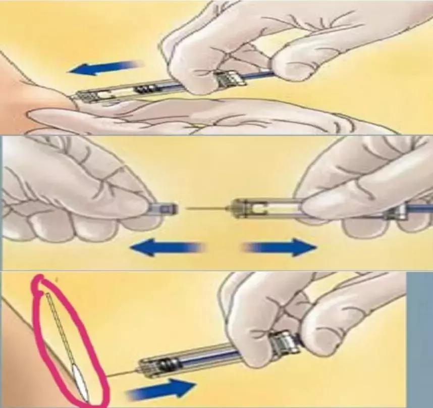 低分子肝素一次注射多少,低分子肝素注射的注意事项