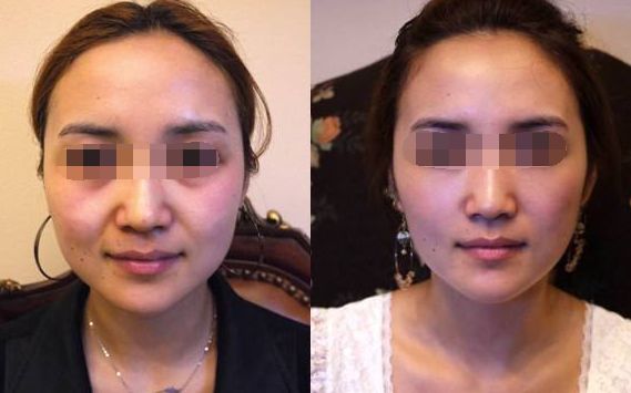 45岁金喜善素颜,金喜善冻龄秘密