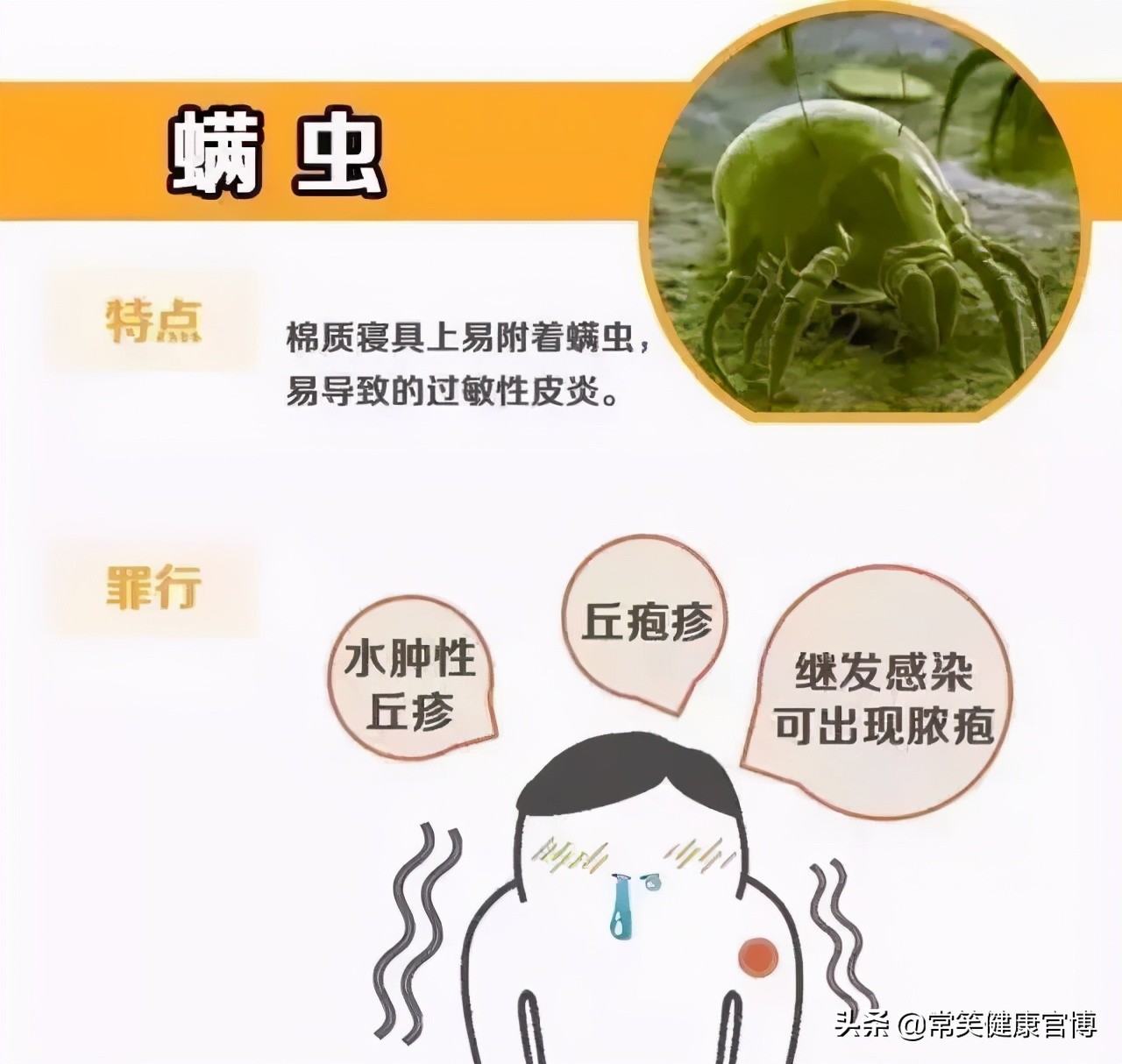 夏季蚊虫肆虐谨防虫咬皮炎,蚊虫痒怎么办快速止痒小妙招