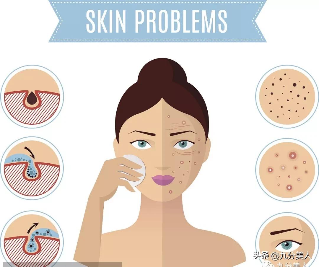 鼻头毛孔粗大是不可逆的吗,油性皮肤毛孔粗大不可逆吗