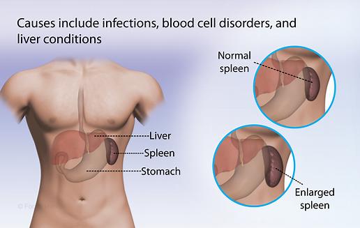 体检说脾增大什么意思,体检报告说肝硬化可能性比较大