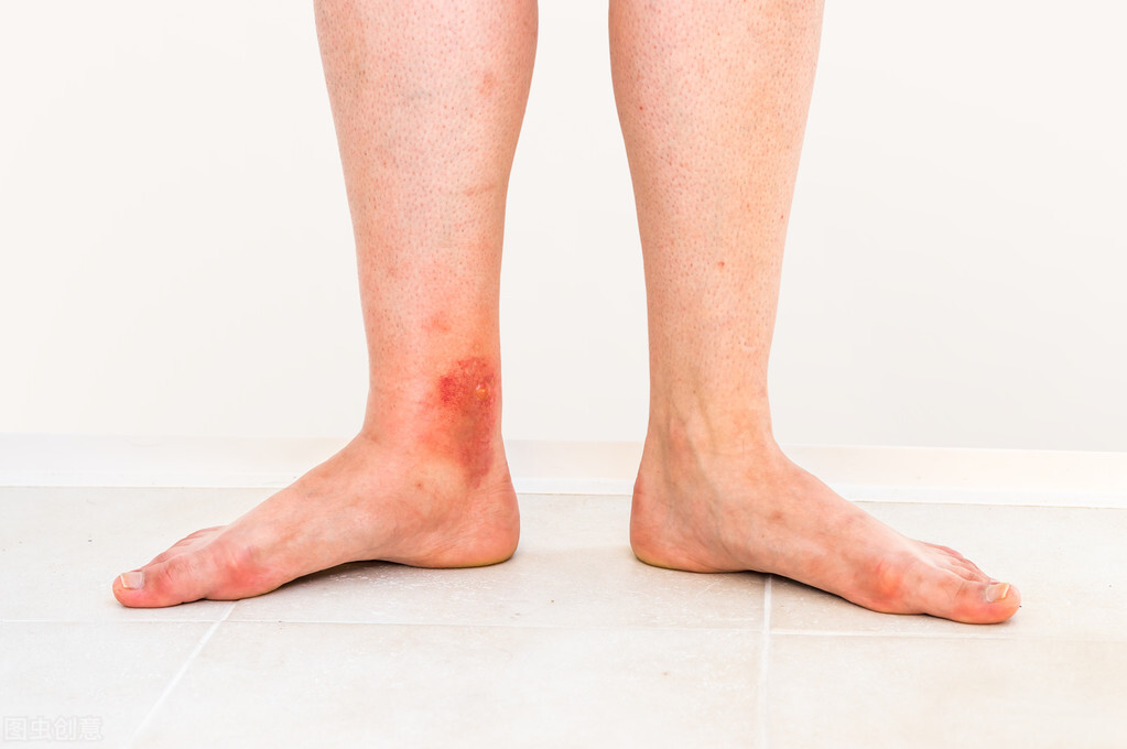 睡前瘦腿操每天练一练打造大长腿,瘦腿操三天瘦出筷子腿100%成功