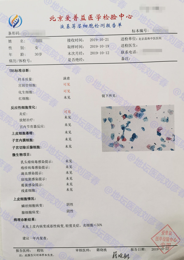 女性霉菌性阴道炎男性有症状吗,女性患了霉菌性阴炎