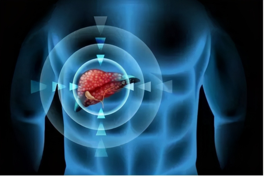 肝癌用靶向药可治愈肝癌吗,肝癌的防治干预计划