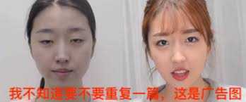 单眼皮肿眼泡割双眼皮多少钱,为什么单眼皮的人喜欢双眼皮