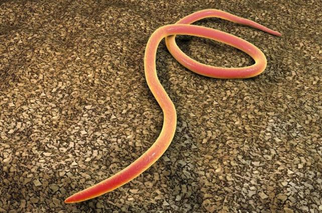 “屁屁痒”的背后，总是藏着这5个原因，希望你不是最后1个