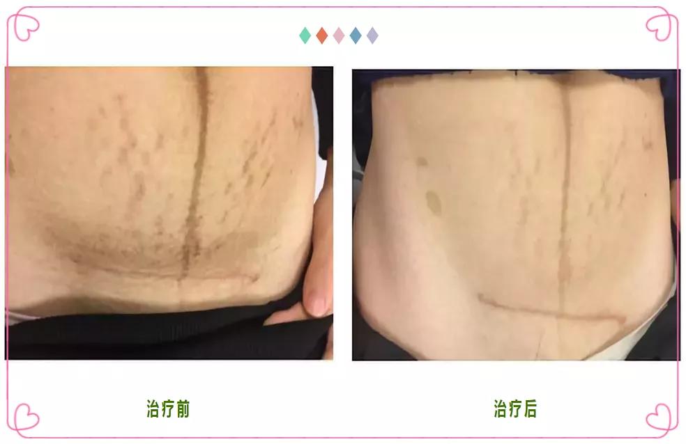 “三八节·女神月”有健康更幸福:免费乳腺B超/盆底筛查/孕妇瑜伽/挂号咨询/当天分娩更有…...