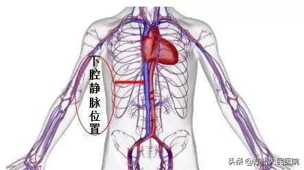 尿血需警惕吸烟也可能引起膀胱癌,尿血要警惕三种疾病