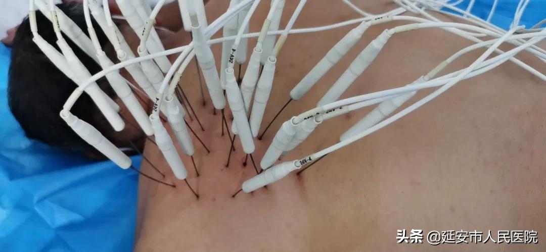 十大困扰老师职业病,有什么可以缓解老师的职业病