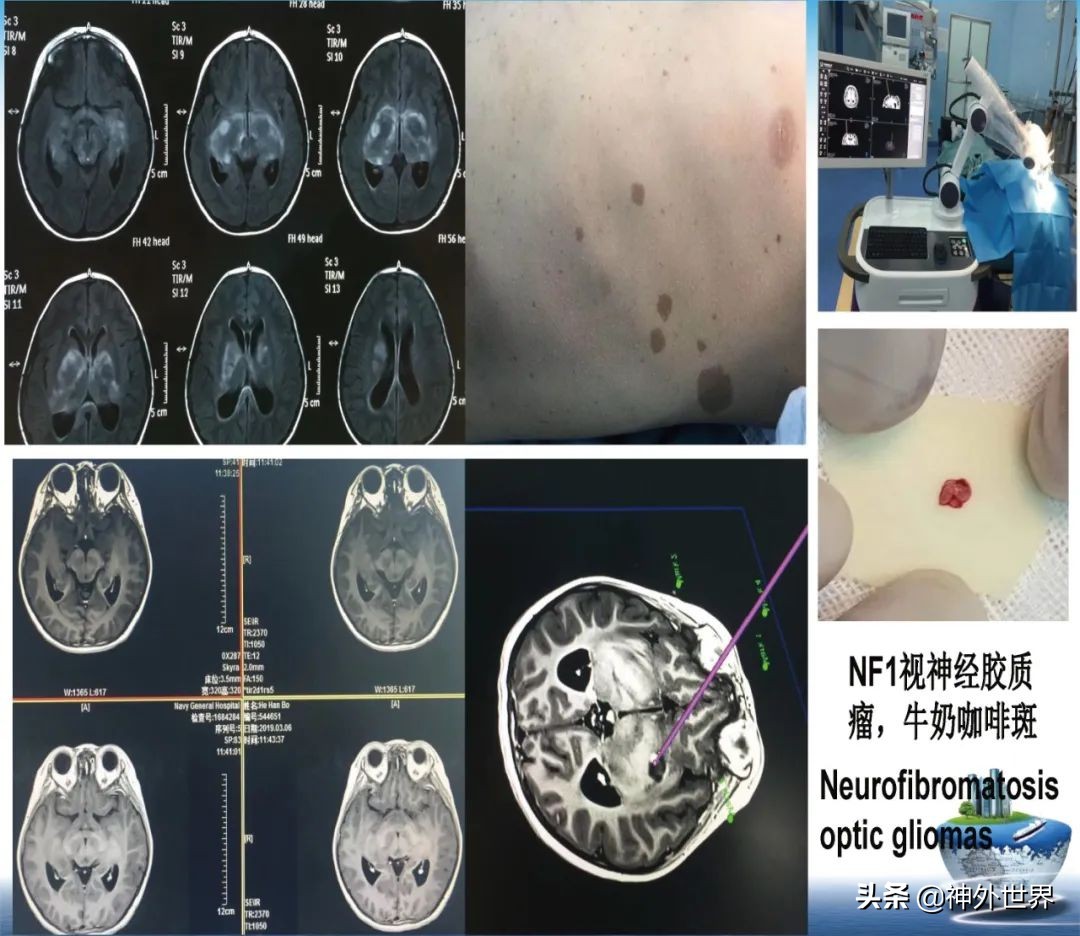 宣武医院神经外科王亚明祖籍,北京宣武医院神经科专家王亚明