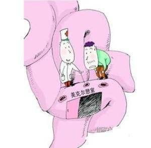 小儿梅克尔憩室炎不便血,蛋白质过敏宝宝便血