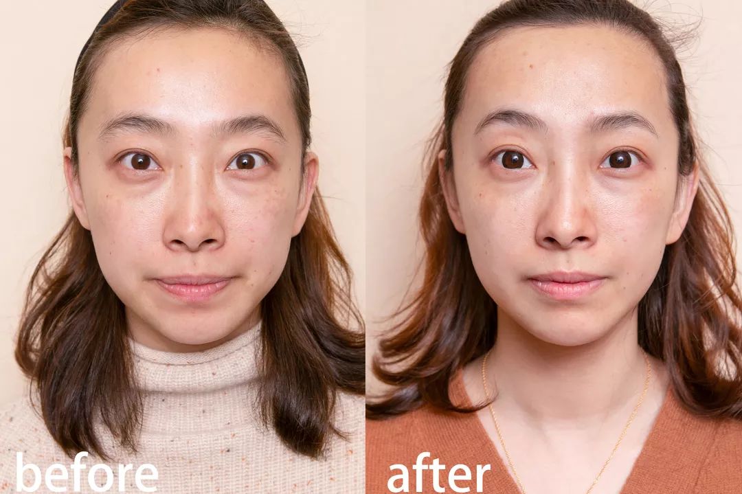 小茂医生美白护肤品,小茂教你如何护肤