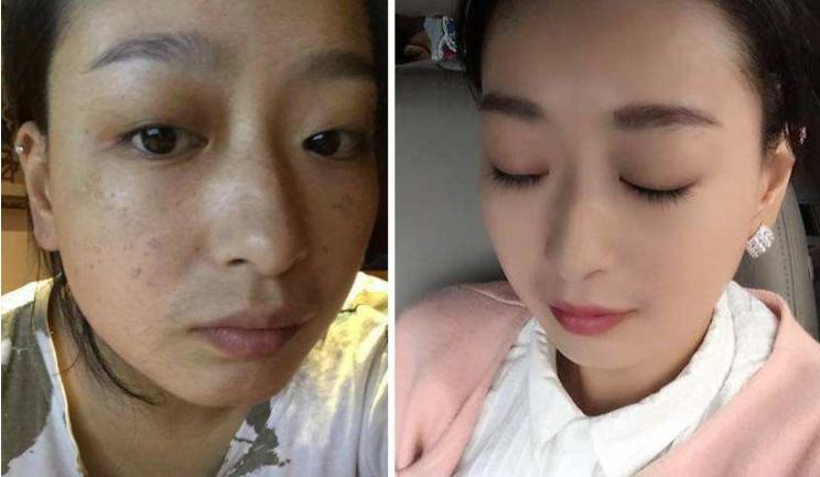 女人嘴周围长斑是什么原因,50岁女人长斑什么原因