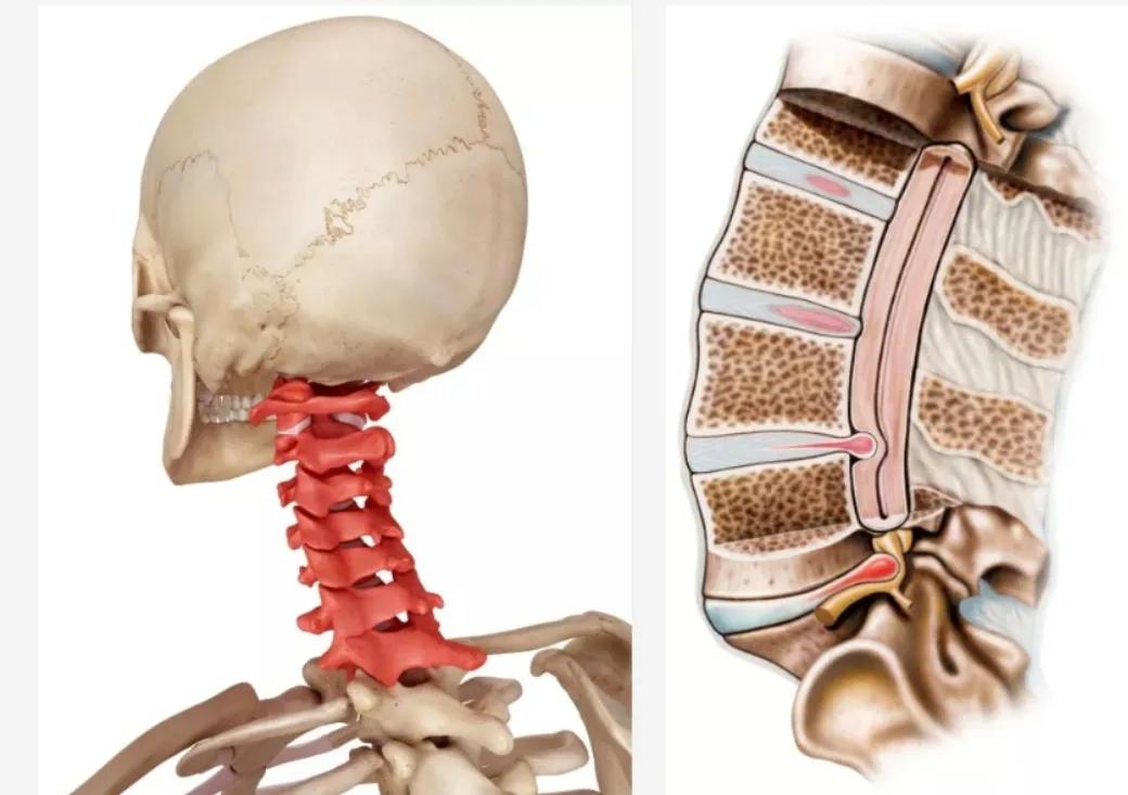 颈椎病常见护理问题,颈椎病患者一定别做这件事
